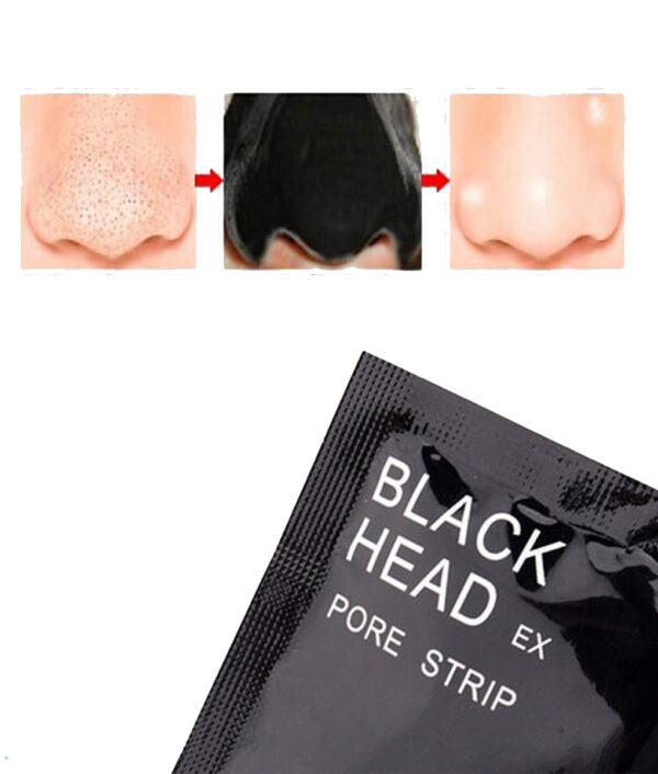 black-mask-acne-removal2