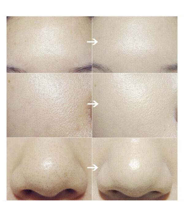 cleaning-brush-skin