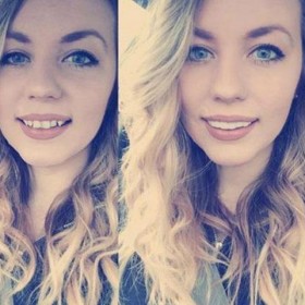 teeth