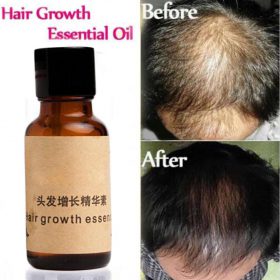 Organic Hair Growth Essence - image 1