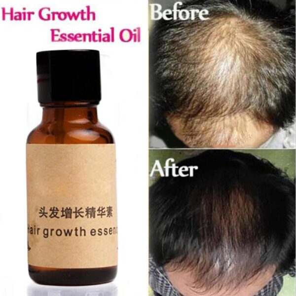 Andrea Hair Growth essence organic coconut argan Hair Oil treatment sa buhok nga paspas nga sunburst nga mga produkto sa pagtubo sa buhok