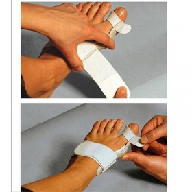 Bunion Corrector - image 3