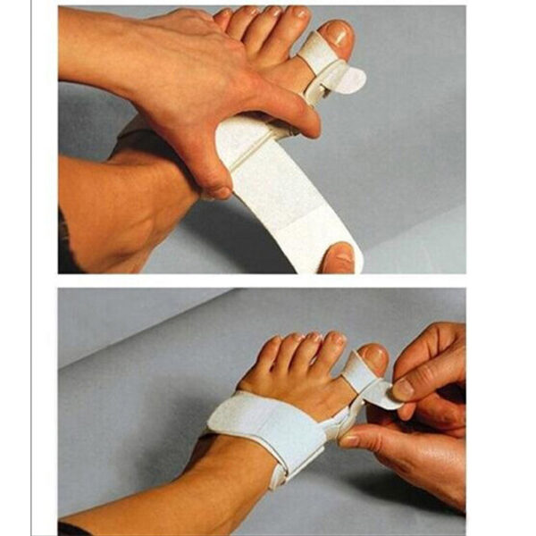 Hallux Valgus Orthotics Big Toe Corrector Foot Pain Relief Feet Care Bone Bunion Corrector Night and 3