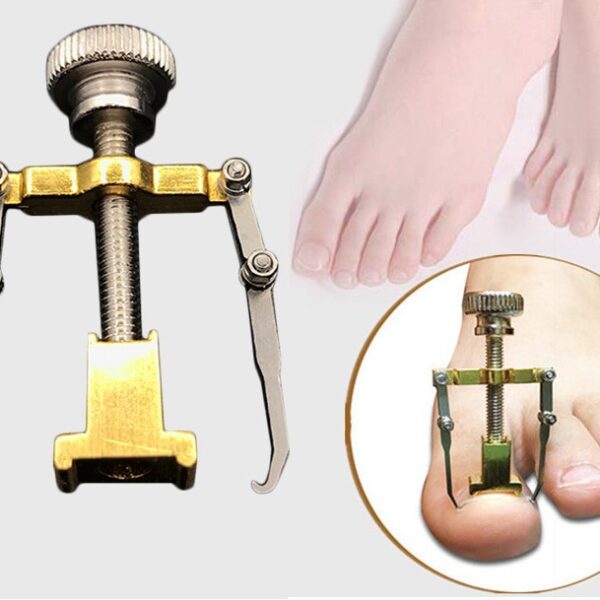 Ingrown-Toenails-Pedicure-Foot-Nail-Care-Tools-File-for-Feet-Orthotic-Acronyx-Ingrowing-Nail-Onyxis-Bunion (1)