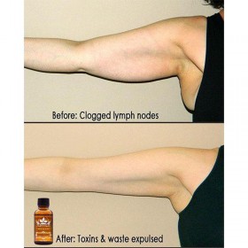 Plant Therapy Lymphatic Drainage Ginger Oil - image 4