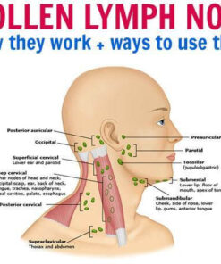 essential oils for swollen lymph nodes 900x