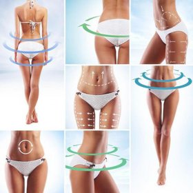 Cellulite Removal Cream - image 5