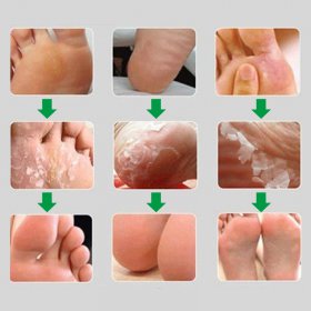 Foot Peel Set - image 6