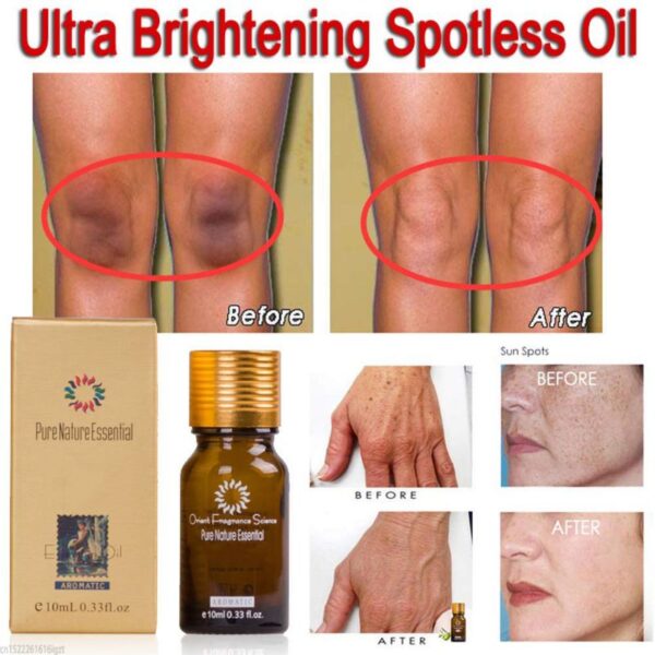 Ultra Brightening Spotless Oil Pure Remove Ance Burn Strentch Marks Scar Removal Lavender Natural Essence Skin