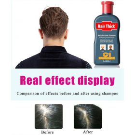 Anti-Hair Loss Shampoo - image 2