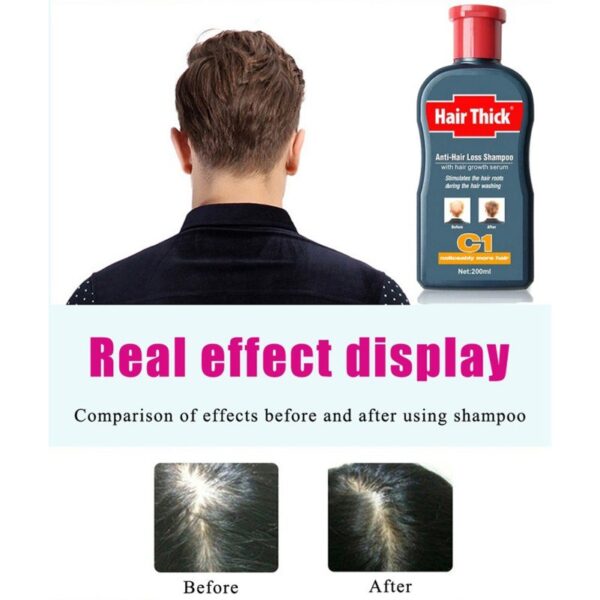100ml Anti Hair Loss Shampoos Hair Thicken Treatment Oil Control Anti Dandruff Itch Hair Care 2