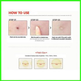 Skin Tag and Acne Patches - image 3