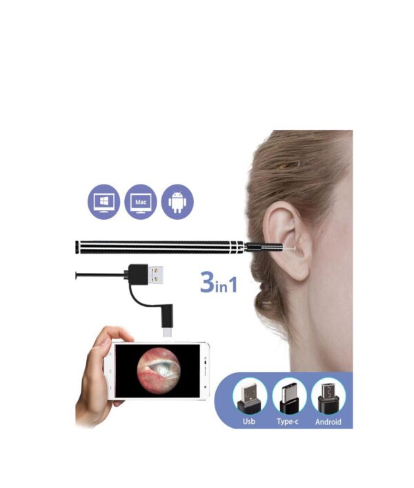 3 in 1 USB Pembersih Telinga Endoskopi HD Visual Sendok Telinga Fungsional Alat Diagnostik Pembersih Telinga