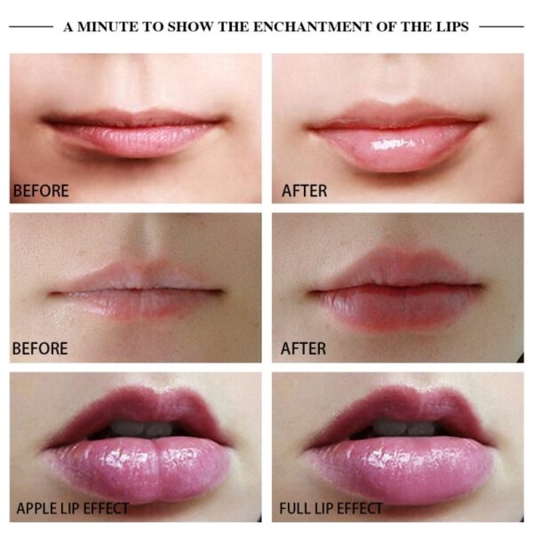 Automatic Lip Plumper Electric Lip Enhancer Intelligent Deflated Designed Lip Plumping Device 5