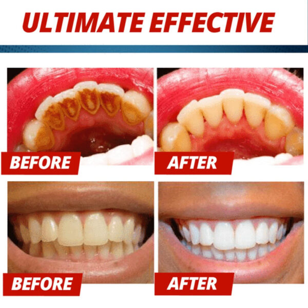 Intensive Stain Removal Whitening Toothpaste Fight Bleeding Gums Toothpaste Passion Fruit Blueberry 4 1