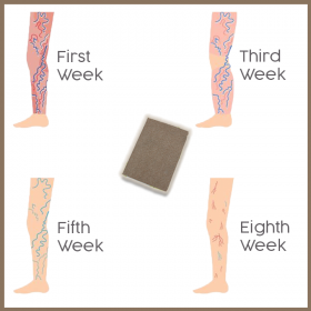 Varicose Veins Herbal Healing Patch - image 5