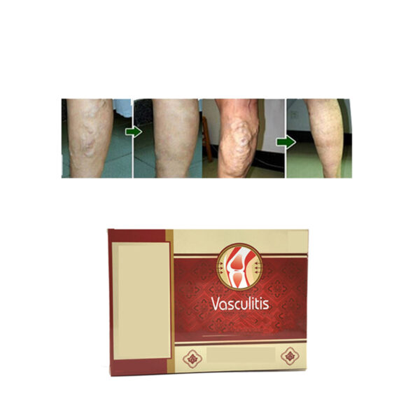 18pcs Varicose Veins Cure Patch Vasculitis Natural Solution Chinese Herbal Treatment Mai Guan Yan Acid Bilges 5 1 1