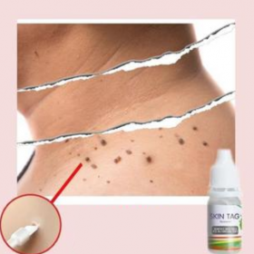 Skin Tag Remover - image 1