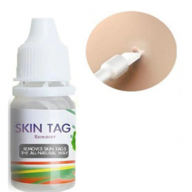 Skin Tag Remover - image 4