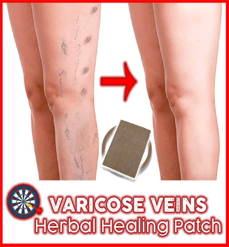 Varicose Veins Herbal Healing Patch - Not sold in stores