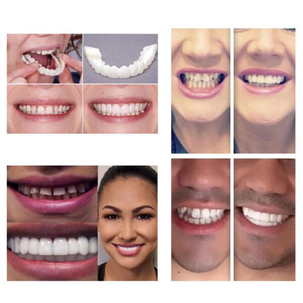 XY כיסוי שיניים להלבנת שיניים מפוארות מושלם לחיוך נוחות התאמה להגמיש ציפוי שיניים 2