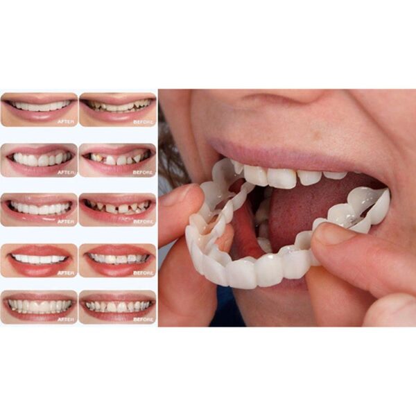 XY Efektné krytie zubov na bielenie zubov Perfect Smile Comfort Fit Flex dýhy na zuby 3
