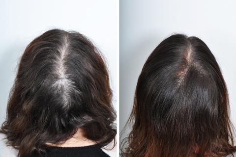 Hair Regrowth Serum, 7Days Hair Regrowth Serum