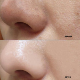Black Mask - Peel off Mask - image 2