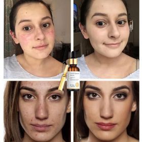 Skin Nourishing Essence - image 10