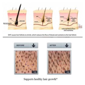 Hair ReGrowth Serum - image 7