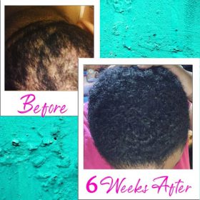 Hair ReGrowth Serum - image 4