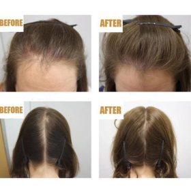 Hair ReGrowth Serum - image 6