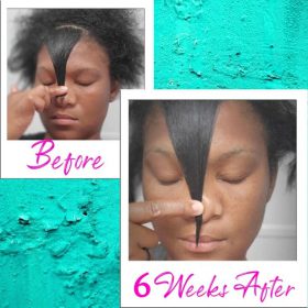 Hair ReGrowth Serum - image 5