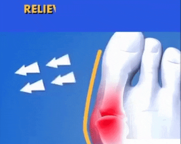 Orthopedic Bunion Corrector, Orthopedic Bunion Corrector