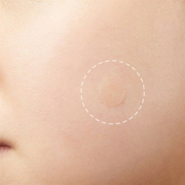 36pcs Patch Skin Care Face Pimple Remover Sticker Patch Facial Cover Patches Skin Tag 2