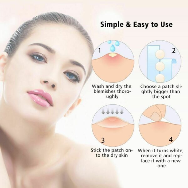 36pcs Patch Skin Care Face Pimple Remover Sticker Patch Facial Cover Facches Tag craiceann 3