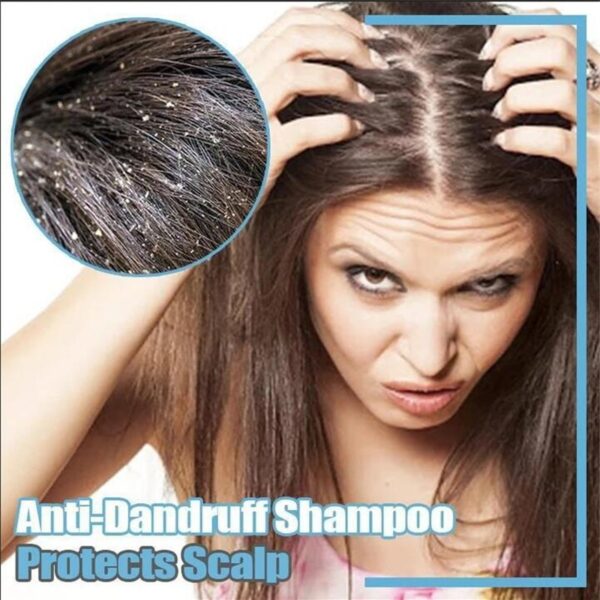 Tamni šampon Bar Ručno rađen Fallopia Multiflora đumbir šampon za kosu Sapun protiv gubitka kose Popravak njege vlasišta 1