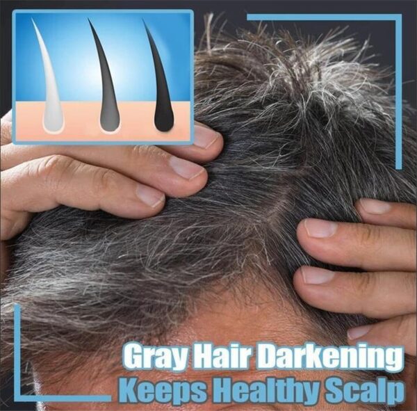 Darkening Shampoo Bar Handmade Fallopia Multiflora Ginger Hair Shampoo Soap Anti Hair Loss Scalp Care Repair 5