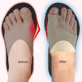 Orthopedic Bunion Corrector - image 7