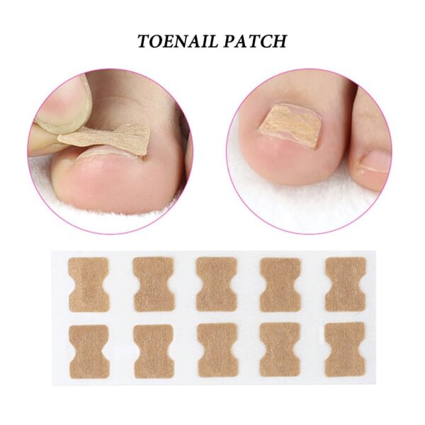 Ingrown Toenail Corrector Sticker Paronychia Treatment Fixer Recover Corrector Pedicure Foot Toe Nail Care Tool Glue 3