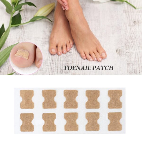 Ingrown Toenail Corrector Sticker Paronychia Treatment Fixer Recover Corrector Pedicure Foot Toe Nail Care Tool Glue 5