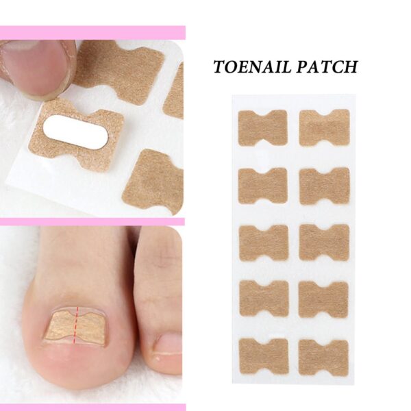 Glue Free Toenail Patch