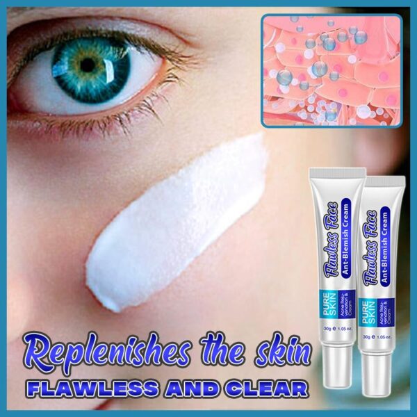 FlawlessFaceAnti Blemish Cream 04 d2c80d68 082b 4204 834a