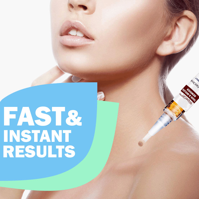 Tags & Moles Wiper - Image 5