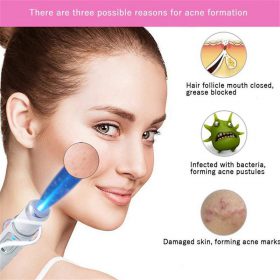 Blue Light Therapy Varicose Veins Pen - image 2