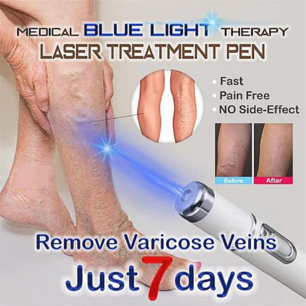 Blauwe ljochttherapy spataderen Behandeling Laserpen Soft Scar Rimpelferwidering Behanneling Akne Laserpen 2