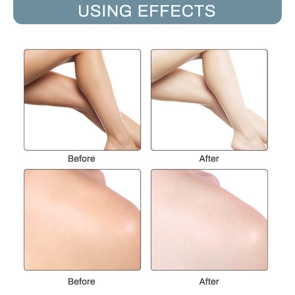 Body Creams Armpit Whitening Cream Between Legs Knees Private Parts Whitening Formula Armpit Whitener Intimate Bleach 1