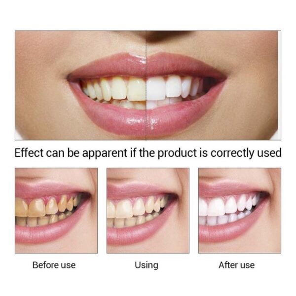LanBeNA higiene bucal líquido de limpieza blanqueador de dientes elimina las manchas de placa dental higiene bucal suero de limpieza elimina 2