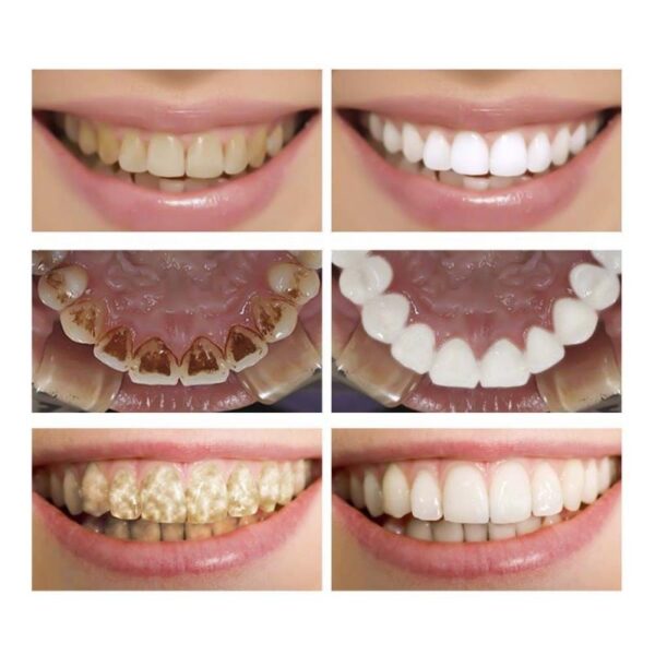 LanBeNA Oral Hygiene Liquid Cleaning Teeth Whitening Removes Plaque Stains Tooth Oral Hygiene Cleaning Serum Removes 3