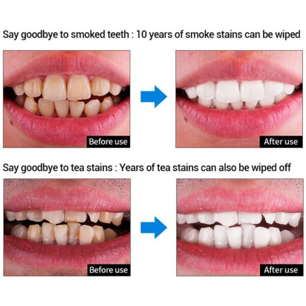 LanBeNA Oral Hygiene Liquid ทำความสะอาดฟันไวท์เทนนิ่งขจัดคราบพลัคฟัน Oral Hygiene Cleaning Serum ขจัด 5